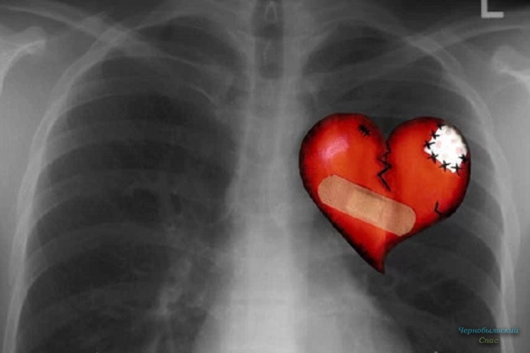 Рентгеновское излучение может нанести вред вашему сердцу