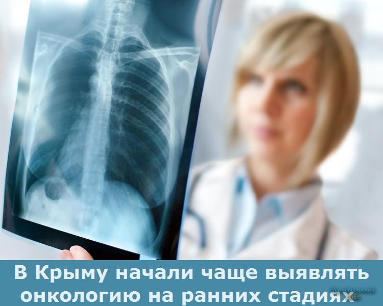 В Крыму начали чаще выявлять онкологию на ранних стадиях