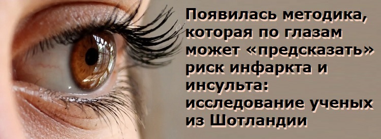 ��������� ��������, ������� �� ������ ����� ������������� ���� �������� � ��������: ������������ ������ �� ���������