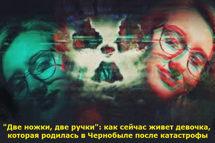 "Две ножки, две ручки": как сейчас живет девочка, которая родилась в Чернобыле после катастрофы "Две ножки, две ручки": как сейчас живет девочка, которая родилась в Чернобыле после катастрофы