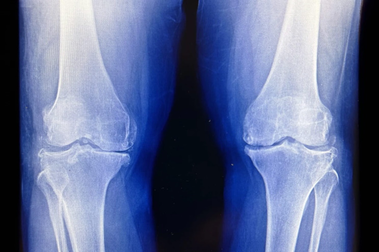 � ����� ����� ������ �������� ������ ����� ��� �������� ��� ������ ����� � ������� ������������� �������