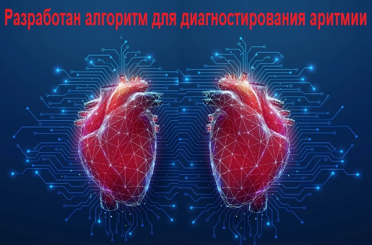 ���������� �������� ��� ���������������� �������