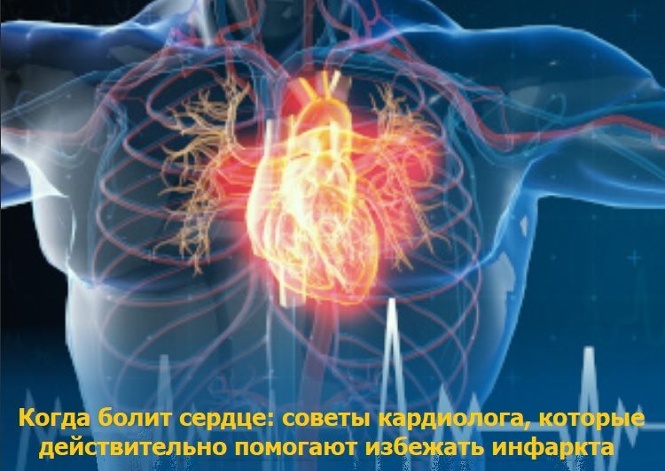 Когда болит сердце: советы кардиолога, которые действительно помогают избежать инфаркта